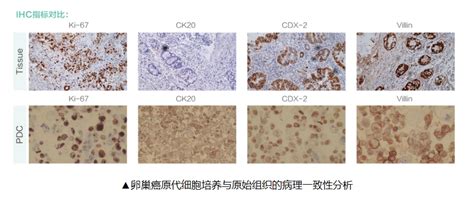 百奥创新原代卵巢癌完全培养基介绍 知乎