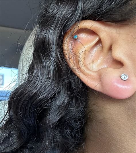 Infected Ear Lobe Piercing