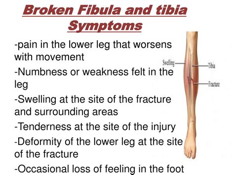 PPT - Fracture of fibula and tibia PowerPoint Presentation, free download - ID:2139888