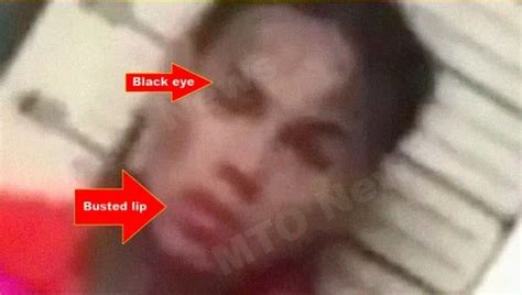 Tekashi 6ix9ine Mugshot Surfaces... Busted Lips And Bruises - Pics