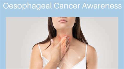 Oesophageal Cancer: Risk factors, symptoms, diagnosis, treatment ...