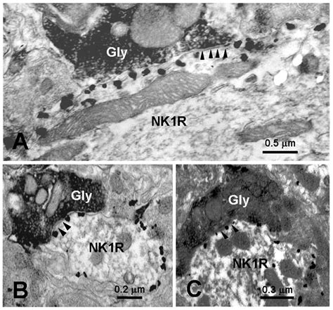 Electron Micrographs Showing The Gly Immunoreactive Axon Terminals