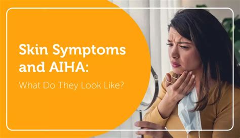 Skin Symptoms and AIHA: What Do They Look Like? | myAIHAteam