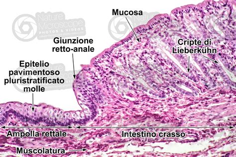 Mammifero Intestino Crasso Sezione Trasversale 125X Intestino