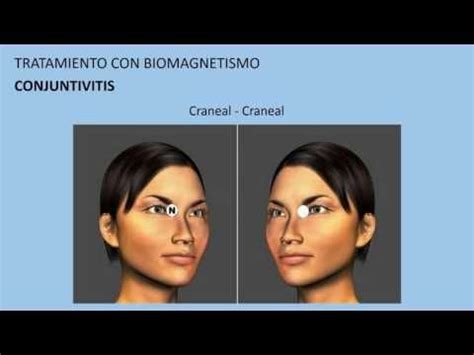 Tratamientos Con Biomagnetismo Youtube Imanes Para Biomagnetismo