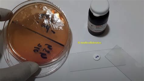 Pseudomonas Aeruginosa Introduction Identification Features