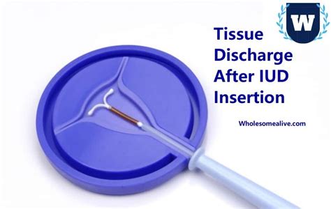 5 Types Of Tissue Discharge After Iud Insertion—treatment And Precautions