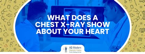 What Does A Chest X-Ray Show About Your Heart - AQ Imaging Network