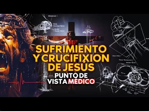 SUFRIMIENTO Y CRUCIFIXION DE JESÚS Punto de vista medico YouTube