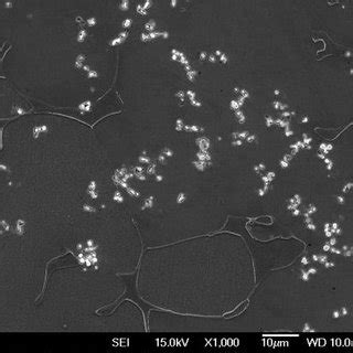 Cast microstructure of austenitic stainless steel at a 1,000x... | Download Scientific Diagram