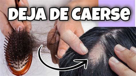 Mi Remedio Casero Poderoso Detiene La Ca Da Funciona Cabello