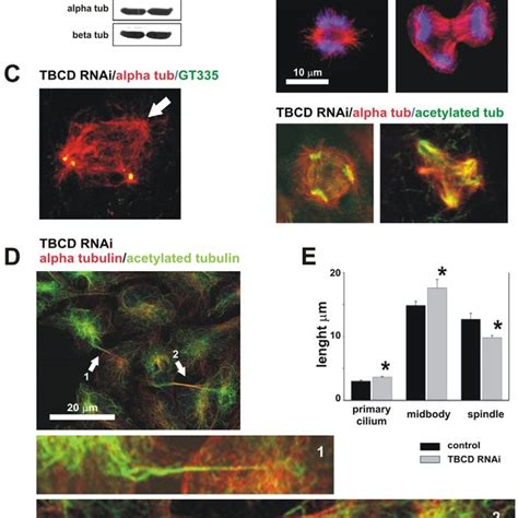 TBCD Overexpression Resulted In Microtubule Detachment From The