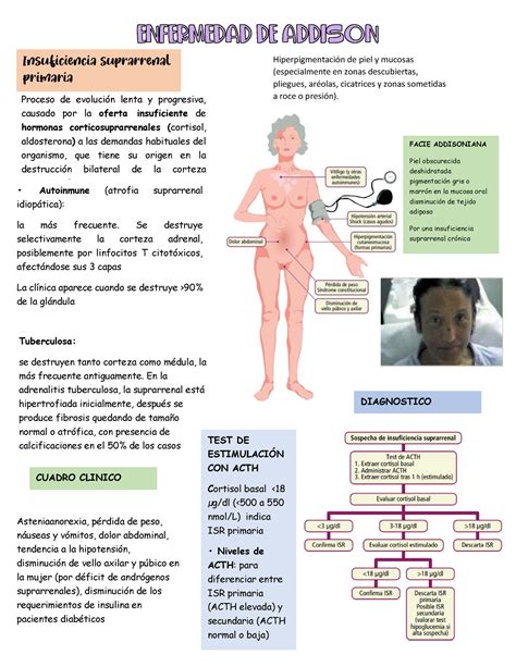 Enfermedad de Addison Proceso de evolución lenta y progresiva