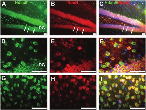 Hdac Is Expressed In Neun Positive Neurons Double Immunostaining Was