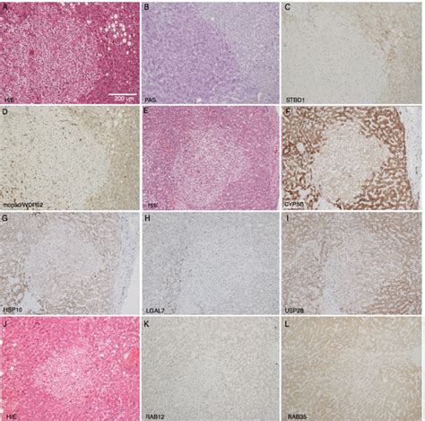 Histochemistry And Immunohistochemistry Of Representative Human Liver Download Scientific