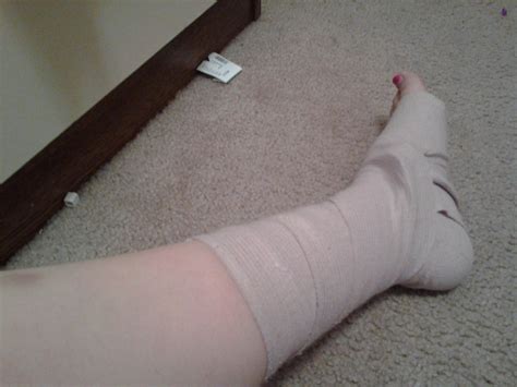 How to Do a Super Wrap for a Sprained Ankle or Foot - Instructables