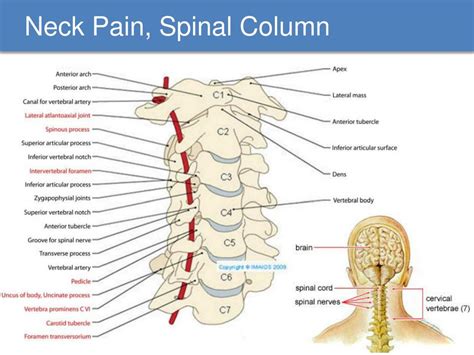 Ppt Treatment Options For Cervical Radiculopathy Powerpoint