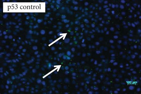 Immunofluorescence Caspase 9 P53 And Bax A Control Cells Showing