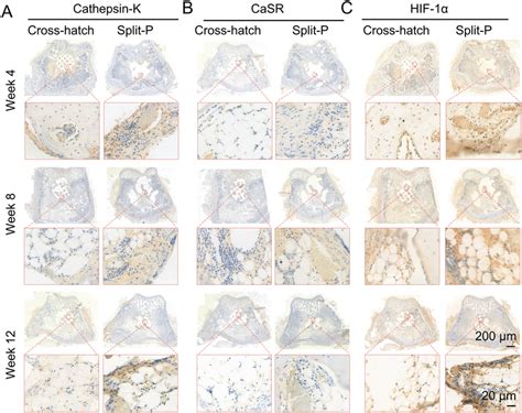 Immunohistochemistry Ihc Staining Of Implanted Scaffolds Ac Ihc Download Scientific