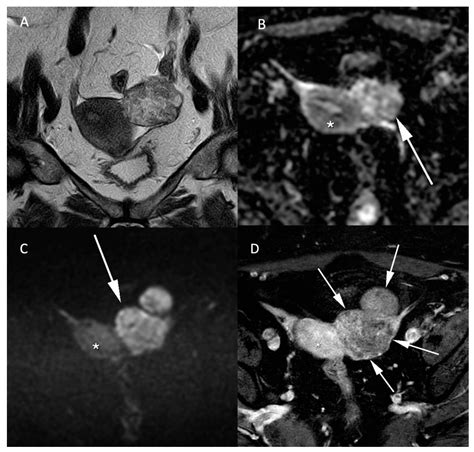 Jcm Free Full Text Diffusion Weighted Mri In The Genitourinary System