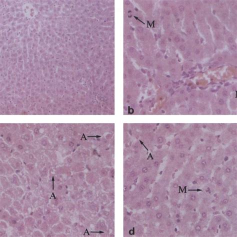 Liver Histology Observed By Electron Microscopy Liver Samples Were