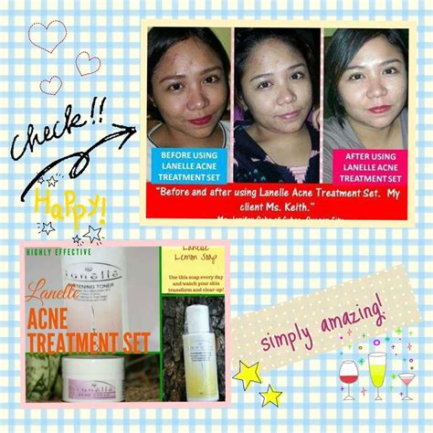 Acne Treatment Toner Transformations Skin Care Happy Beauty