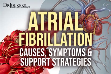 Atrial Fibrillation Causes Symptoms And Natural Support Strategies