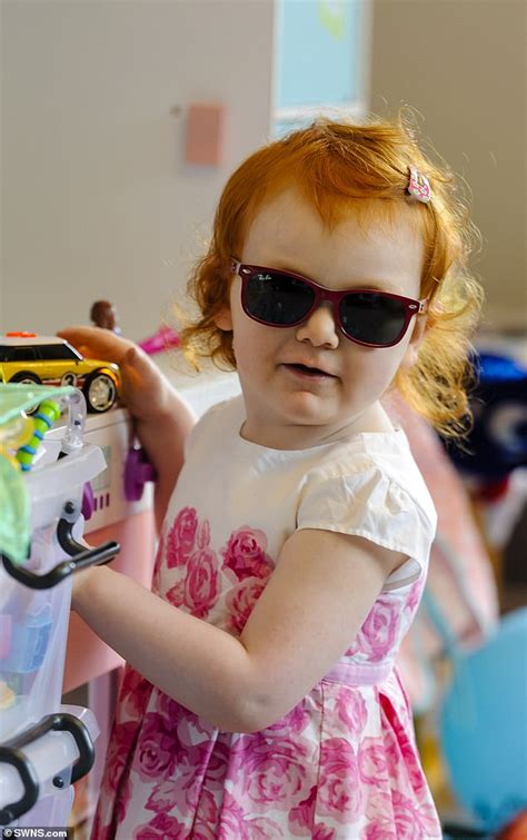 Girl Born With No Irises In Her Eyes Has To Wear Sunglasses To Protect