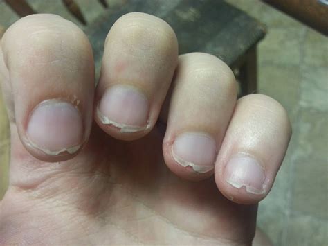 Broken fingernails don't annoy my buddy. He sent me this ...