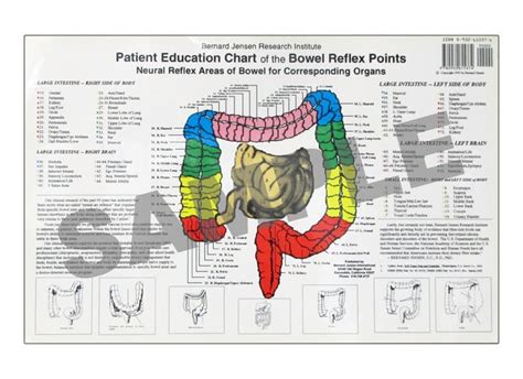 Item 2307 Patient Education Chart Of The Bowel Reflex Points Patient