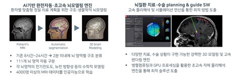 약물 없이 정밀하게 뇌질환 치료 가능성 ↑