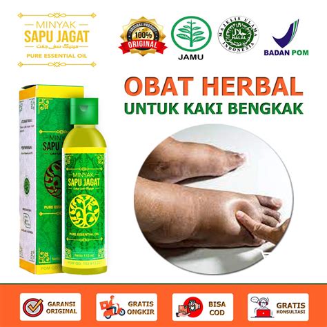 Jual Obat Kaki Bengkak Karena Keseleo Jatuh Diabetes Asam Urat Ginjal