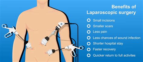 Keyhole Gallbladder Surgery Laparoscopic Cholecystectomy