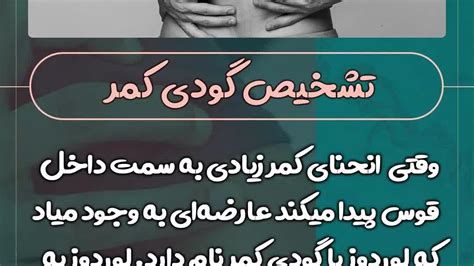 تشخیص گودی کمر نماشا