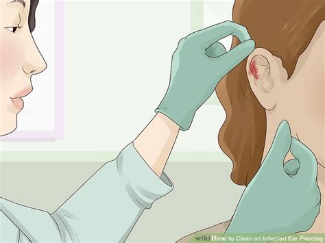 3 Ways To Clean An Infected Ear Piercing Wikihow