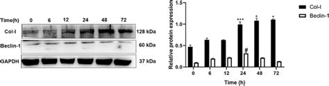 Western Blotting Was Used To Detect The Col I And Beclin 1 Protein