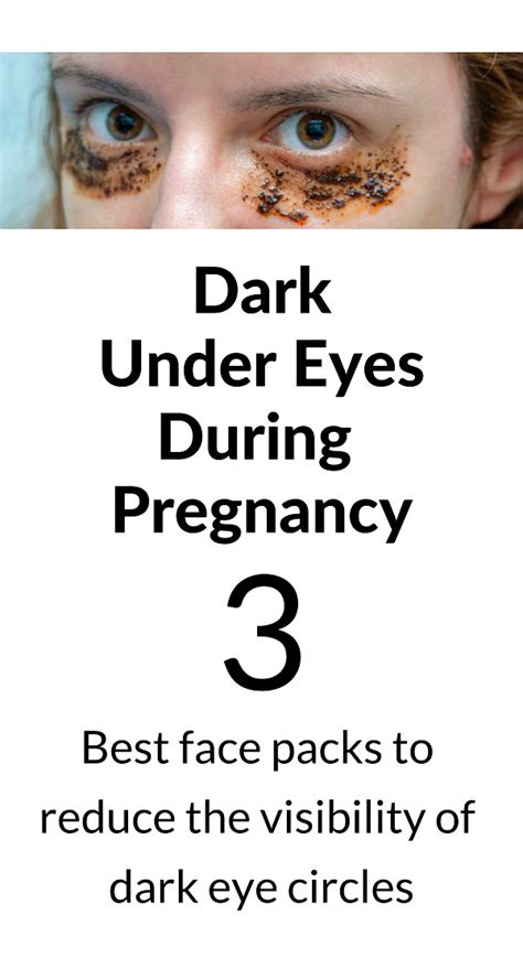 Dark Eye Circles During Pregnancy 3 Best Treatments