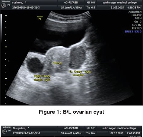 Table 1 From Role Of Ultrasonography And Color Doppler To Diagnosis Of