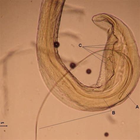 Male Back End Of Habronema Majus X 157 A Right Spiculum B Left