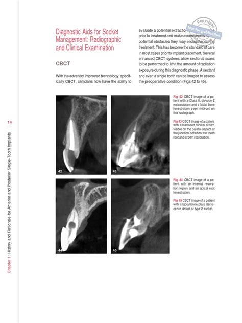 Classification Of Gingival Biotype With Diagnostic Method Pdf