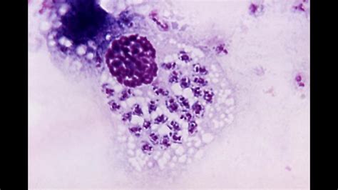 Deadly 'Kissing Bug' Disease Continues To Spread | wfmynews2.com