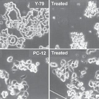 Effect Of Fenretinide Treatment On Pax Tubulin Iii Nse