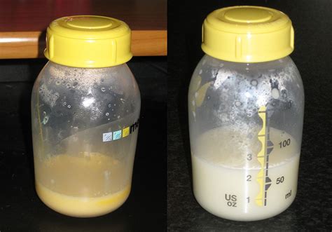 File:Colostrum vs breastmilk.jpg - Wikimedia Commons