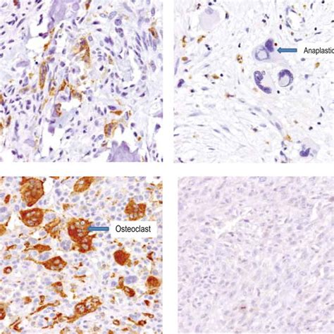 Rankl And Rank Expression Within Adjacent Bone Tissue Rankl And Rank