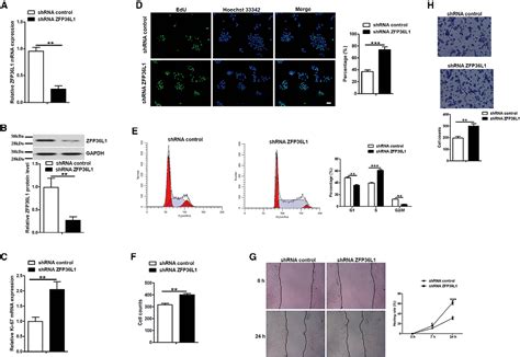 Figure 4 From The MiR 93 3p ZFP36L1 ZFX Axis Regulates Keratinocyte