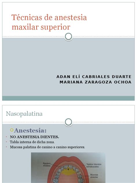 Pdf T Cnicas De Anestesia Maxilar Superior Pdfslide Net