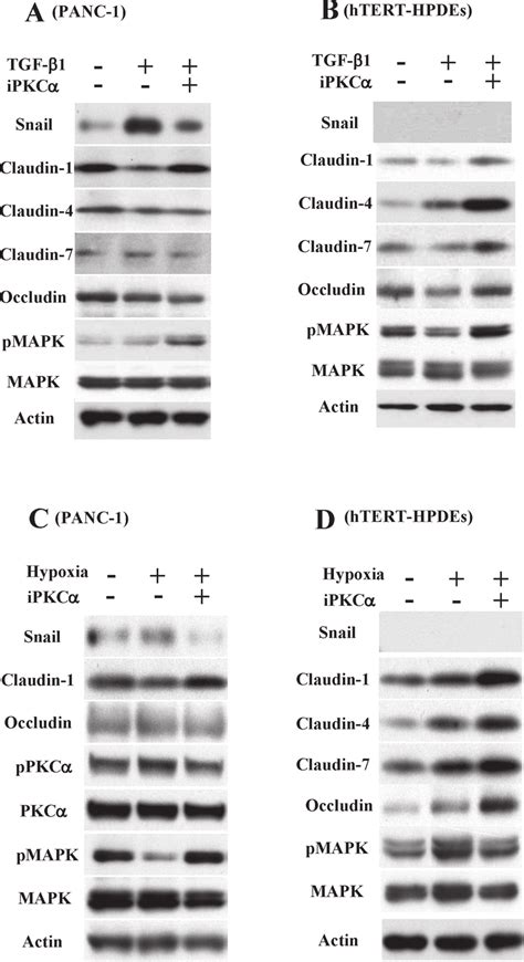 A Western Blotting For Snail Claudin 1 4 7 Occludin Pmapk And