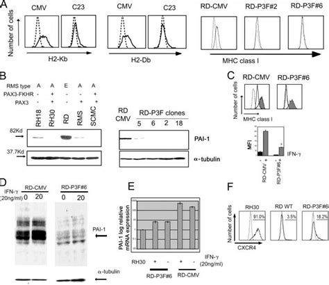 PAX3 FKHR Substantially Down Regulates PAI 1 And MHC Class I Protein