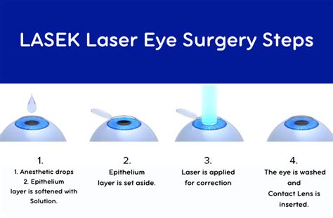 Lasek Laser Eye Surgery Smart Laser Eye Center