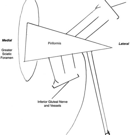 Diagram To Demonstrate The Anatomy And Relationship Of The Superior